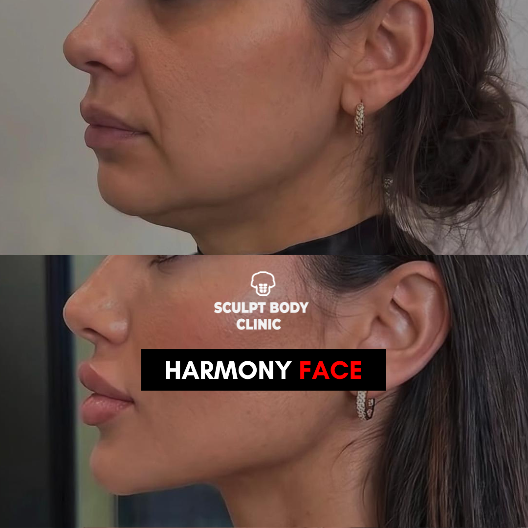 Harmony Face 1