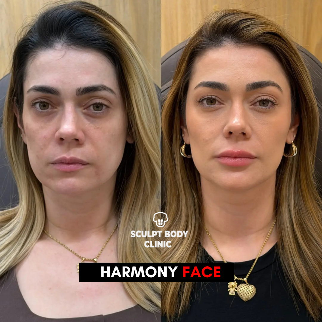 Harmony Face 2
