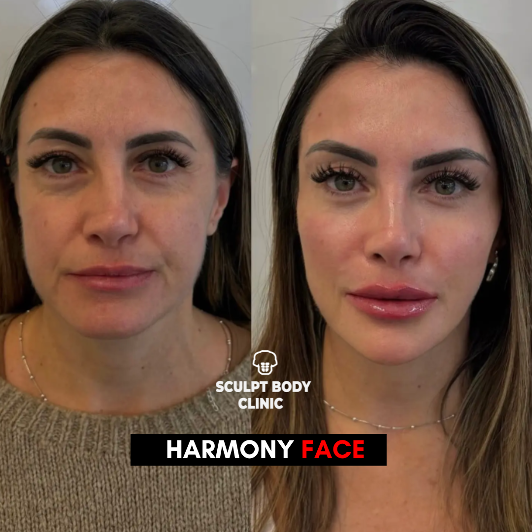 Harmony Face 3